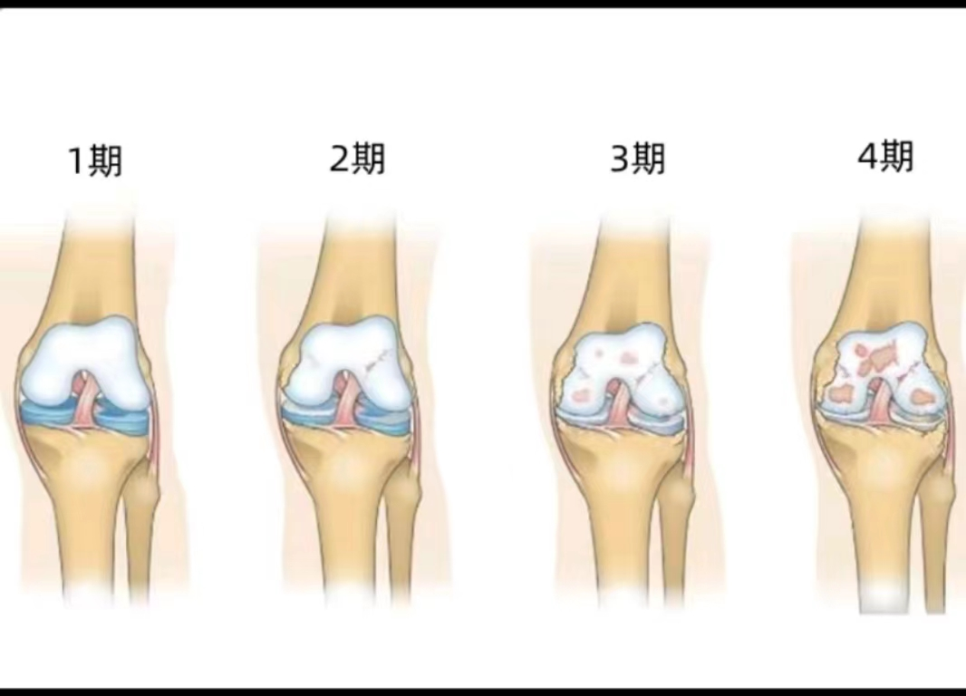 1710985480160106.png 图片 1.png