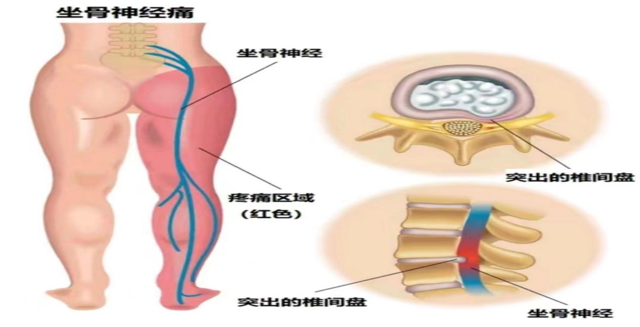1718070922183517.png 图片 7.png
